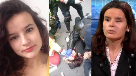 Photos show protester Fiorina Jacob Lignier before and after she was struck by a police gas grenade.