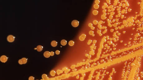 FILE PHOTO: Colonies of E. coli bacteria grown on an agar plate are seen in a microscopic image.