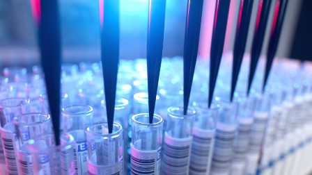 ایچ آئی وی کے خلاف بڑی کامیابی: مدافعتی  خلیوں میں جینیاتی تبدیلی سے محققین کا زیادہ مؤثر ویکسین اور دوا بنانے کا دعویٰ