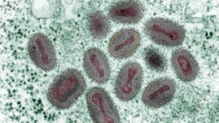 امریکہ میں دوا ساز نجی کمپنی کی لیبارٹری سے غیر قانونی طور پر محفوظ کردہ چیچک وائرس کے 15 نمونے برآمد: لیبارٹری بند، تحقیقات شروع